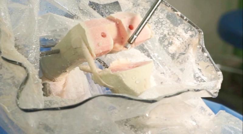 큐렉소 인공관절 수술로봇 "CUVIS-Joint"