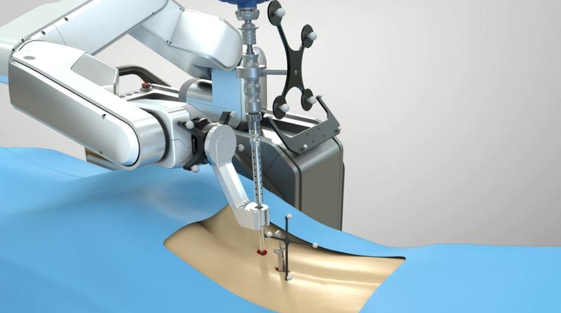 큐렉소 척추 수술로봇  "CUVIS-Spine"